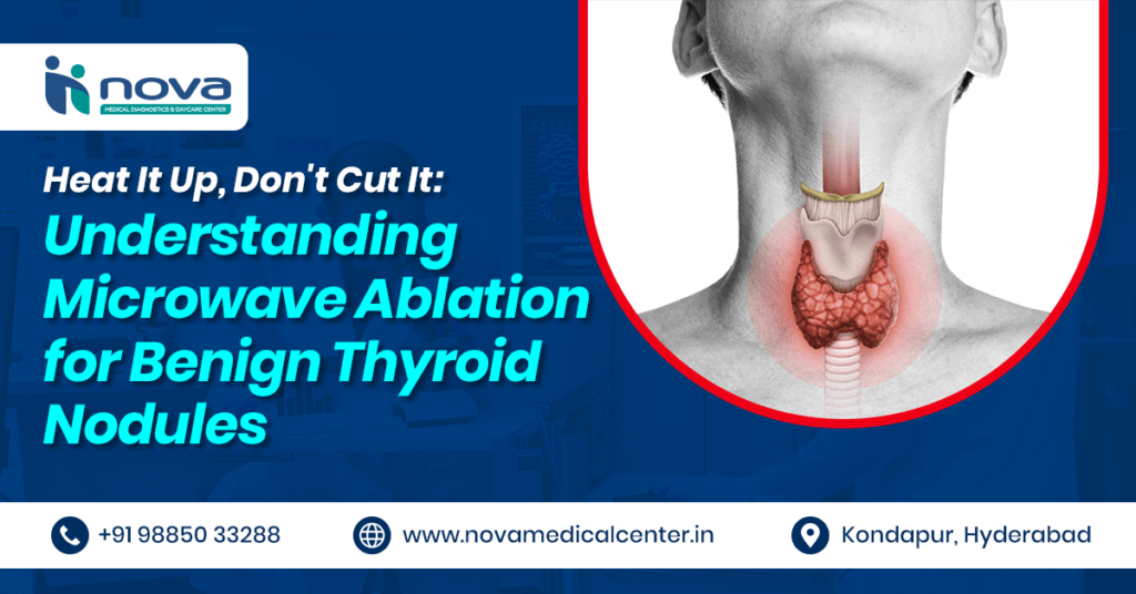 understanding-microwave-ablation-thyroid-health