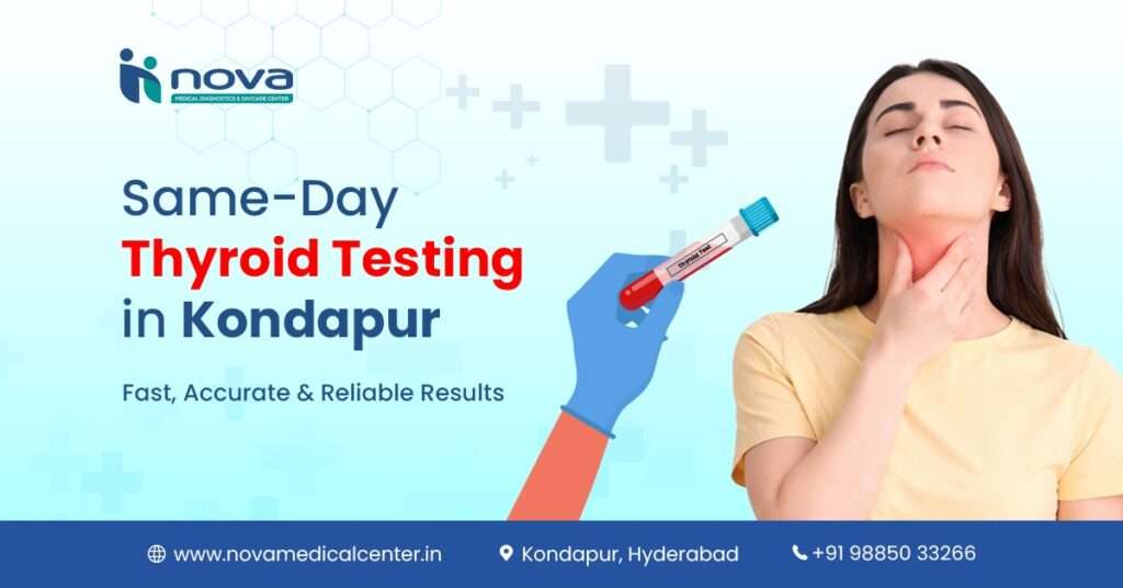 same-day-thyroid-test-kondapur-t3-t4-tsh