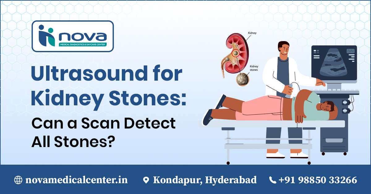 /ultrasound-for-kidney-stones-kondapur/